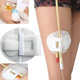 Ewinodon 714453521806 5pcs Catheter Stabilization Device Legband Holder Sticker Tube Holde