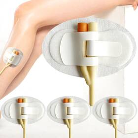 Guatbsecure 744110794656 4pcs Catheter Stabilization Device Legband Holder Tube
